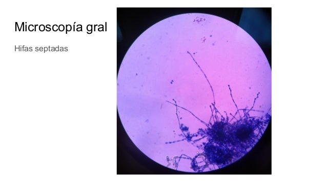 micologia medica